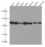 MFN2 Antibody in Western Blot (WB)