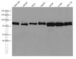 MFN2 Antibody in Western Blot (WB)