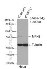 MFN2 Antibody in Western Blot (WB)