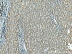 HRD1/SYVN1 Antibody in Immunohistochemistry (Paraffin) (IHC (P))