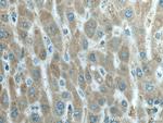 HRD1/SYVN1 Antibody in Immunohistochemistry (Paraffin) (IHC (P))