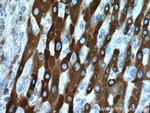 HSD17B6 Antibody in Immunohistochemistry (Paraffin) (IHC (P))