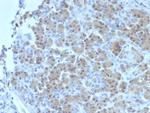 BRCA2 (Breast Marker) Antibody in Immunohistochemistry (Paraffin) (IHC (P))