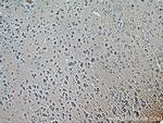 RAB2A Antibody in Immunohistochemistry (Paraffin) (IHC (P))