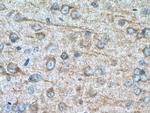 CDK5R1 Antibody in Immunohistochemistry (Paraffin) (IHC (P))