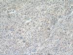 ACO2 Antibody in Immunohistochemistry (Paraffin) (IHC (P))