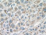 ACO2 Antibody in Immunohistochemistry (Paraffin) (IHC (P))