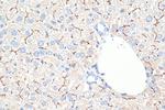 BSEP Antibody in Immunohistochemistry (Paraffin) (IHC (P))