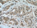 ZEB2 Antibody in Immunohistochemistry (Paraffin) (IHC (P))