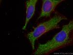 TPI1 Antibody in Immunocytochemistry (ICC/IF)