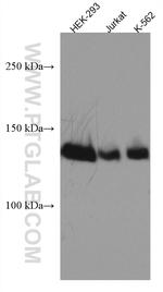 SALL2 Antibody in Western Blot (WB)