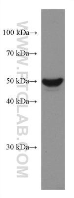 GSDMB Antibody in Western Blot (WB)