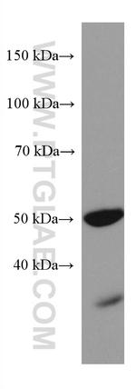 PAX6 Antibody in Western Blot (WB)