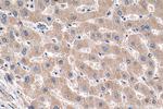 SLC2A9 Antibody in Immunohistochemistry (Paraffin) (IHC (P))