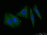 GPT/ALT1 Antibody in Immunocytochemistry (ICC/IF)