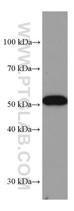 GPT/ALT1 Antibody in Western Blot (WB)