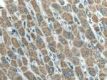 Tim23 Antibody in Immunohistochemistry (Paraffin) (IHC (P))