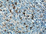 KLRB1/CD161 Antibody in Immunohistochemistry (Paraffin) (IHC (P))