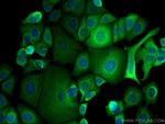 CCT8 Antibody in Immunocytochemistry (ICC/IF)