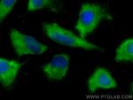 CCT7 Antibody in Immunocytochemistry (ICC/IF)