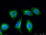 UAP1 Antibody in Immunocytochemistry (ICC/IF)