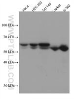 UAP1 Antibody in Western Blot (WB)