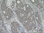 UQCRC2 Antibody in Immunohistochemistry (Paraffin) (IHC (P))