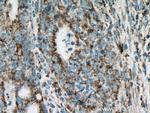 UQCRC2 Antibody in Immunohistochemistry (Paraffin) (IHC (P))