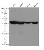 Septin 9 Antibody in Western Blot (WB)