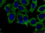 EEF2 Antibody in Immunocytochemistry (ICC/IF)