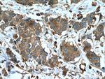 EEF2 Antibody in Immunohistochemistry (Paraffin) (IHC (P))