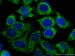 RIG-1/DDX58 Antibody in Immunocytochemistry (ICC/IF)