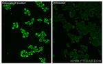 Phospho-GSK3B (Ser9) Antibody in Immunocytochemistry (ICC/IF)