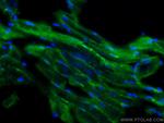 MTMR14 Antibody in Immunohistochemistry (Paraffin) (IHC (P))