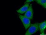 STAT4 Antibody in Immunocytochemistry (ICC/IF)