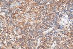 STAT4 Antibody in Immunohistochemistry (Paraffin) (IHC (P))