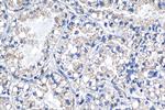 PTP4A1 Antibody in Immunohistochemistry (Paraffin) (IHC (P))