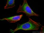 Calumenin Antibody in Immunocytochemistry (ICC/IF)