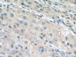 VPS18 Antibody in Immunohistochemistry (Paraffin) (IHC (P))