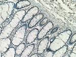 Importin Beta Antibody in Immunohistochemistry (Paraffin) (IHC (P))