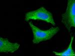 GSS Antibody in Immunocytochemistry (ICC/IF)