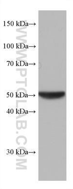 GSS Antibody in Western Blot (WB)