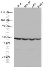 GSS Antibody in Western Blot (WB)