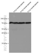 SERPIND1 Antibody in Western Blot (WB)