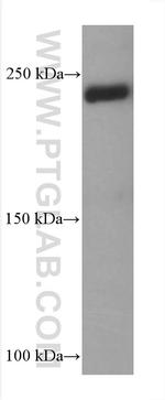 Collagen Type V Antibody in Western Blot (WB)