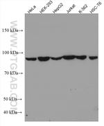 VPS53 Antibody in Western Blot (WB)