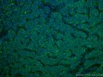 WASF3 Antibody in Immunohistochemistry (Paraffin) (IHC (P))