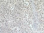 PSME3 Antibody in Immunohistochemistry (Paraffin) (IHC (P))