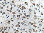 GRIA1 Antibody in Immunohistochemistry (Paraffin) (IHC (P))