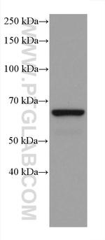 GAD1 Antibody in Western Blot (WB)